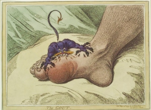 Gout Illustrationa02